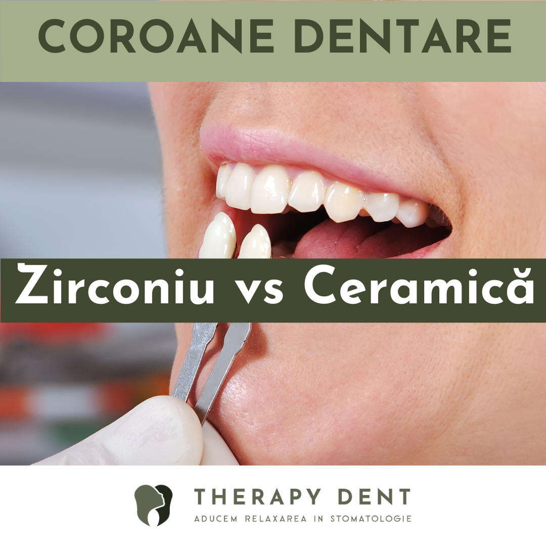 Coroane dentare: Zirconiu vs Ceramică